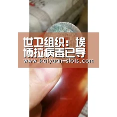 世卫组织:埃博拉病毒已导致660人丧生【开元官网】(图2) 开元官方